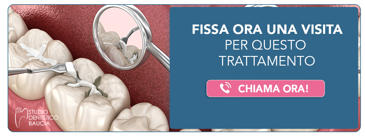 intarsio-dentale Cavenago di Brianza (MB) e Castano Primo (Milano)